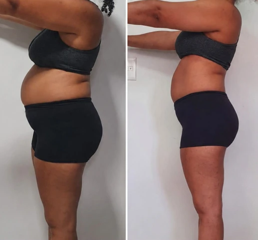 Perfil da barriga antes e depois, segunda aluna